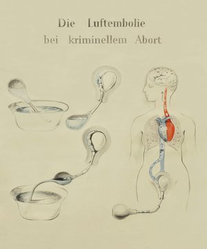 Martha Pfannenschmid, Lehrtafel &copy; IRM Basel