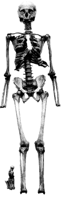 Von Vesal pr&auml;pariertes Skelett